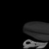 SPORK, NICO - 22.03.1976 - 02.08.2022 - CT obere Extremität - 17:59:38